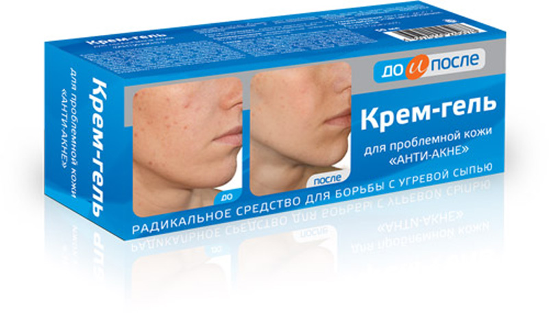 До и После Крем-гель Анти-акне, крем-гель, 50 мл, 1 шт, для проблемной кожи фото