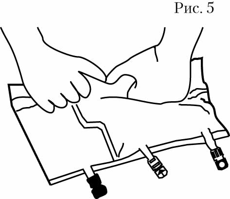 Инструкция по применению Кабивен центральный, эмульсия для инфузий, 1540 мл, 4 шт. - схема 4