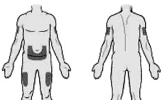 Инструкция по применению Мирцера, 50 мкг, раствор для внутривенного и подкожного введения, 0.3 мл, 1 шт. - схема 4