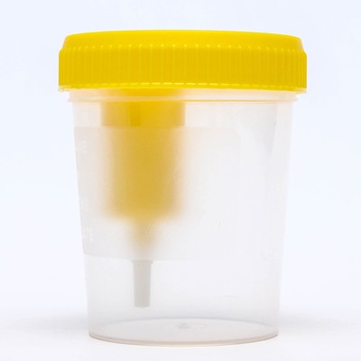 Контейнер для биоматериалов стерильный, 120 мл, 1 шт, с устройством для вакуумного отбора мочи фото