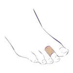 Тривес Протектор защитный для пальцев стопы СТ-65, р. L, 1 шт. фото 2