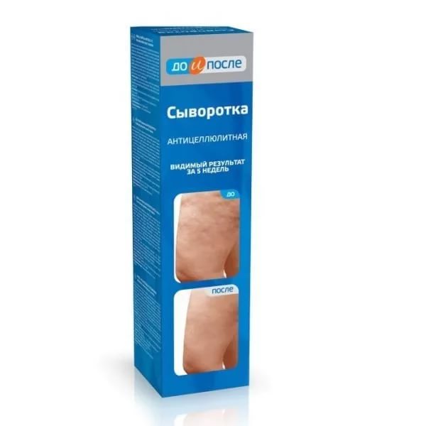 До и После Сыворотка антицеллюлитная, сыворотка, 130 мл, 1 шт. фото