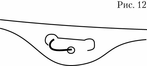 Инструкция по применению Кабивен центральный, эмульсия для инфузий, 1540 мл, 4 шт. - схема 11