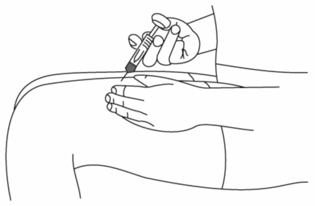 Инструкция по применению Стелара, 90 мг/мл, раствор для подкожного введения, 1 мл, 1 шт. - схема 7