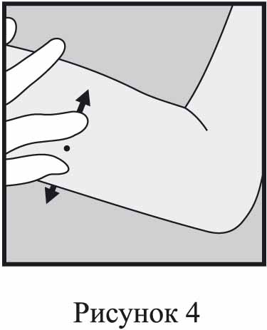 Инструкция по применению Импланон НКСТ, 68 мг, 1 шт. - схема 4