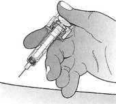 Инструкция по применению Пролиа, 60 мг/мл, раствор для подкожного введения, 1 мл, 1 шт. - схема 6