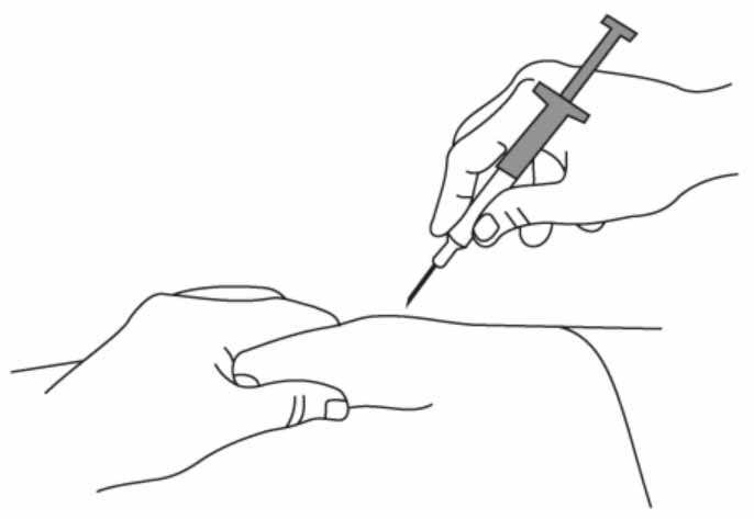 Инструкция по применению Стелара, 90 мг/мл, раствор для подкожного введения, 1 мл, 1 шт. - схема 5