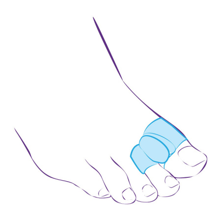 Тривес Перегородка межпальцевая с кольцами на 1-й и 2-й пальцы, р. L, 1 шт, арт. СТ-54.2 фото