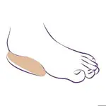 Тривес Подпяточники ортопедические амортизирующие СТ-233, р. L, 2 шт. фото 2