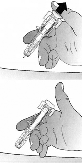 Инструкция по применению Пролиа, 60 мг/мл, раствор для подкожного введения, 1 мл, 1 шт. - схема 7