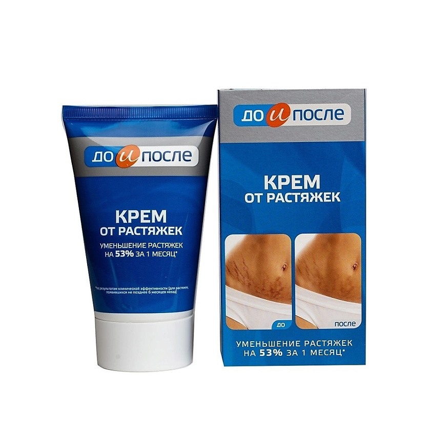 ДО и ПОСЛЕ Крем после растяжек, крем, 100 мл, 1 шт. фото