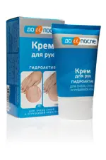 До и После Крем для рук Гидроактив для сухой и огрубевшей кожи, крем для рук, 100 мл, 1 шт. фото