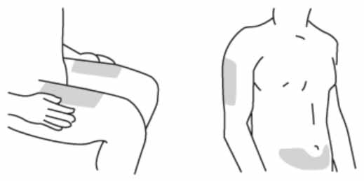 Инструкция по применению Стелара, 90 мг/мл, раствор для подкожного введения, 1 мл, 1 шт. - схема 1