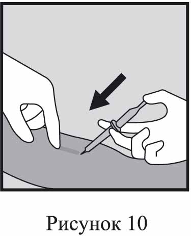 Инструкция по применению Импланон НКСТ, 68 мг, 1 шт. - схема 10