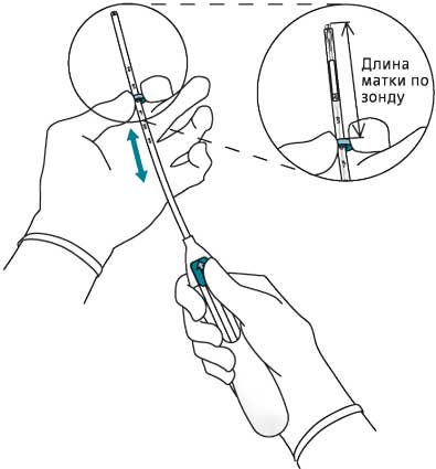 Инструкция по применению Мирена, 20 мкг/24 ч, внутриматочная терапевтическая система, 1 шт. - схема 3