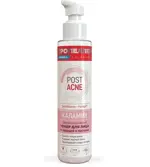 Пропеллер Post Acne Каламин Тонер для лица дерматологический, 100 мл, 1 шт. фото