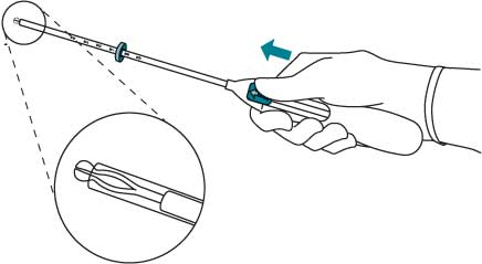 Инструкция по применению Мирена, 20 мкг/24 ч, внутриматочная терапевтическая система, 1 шт. - схема 2